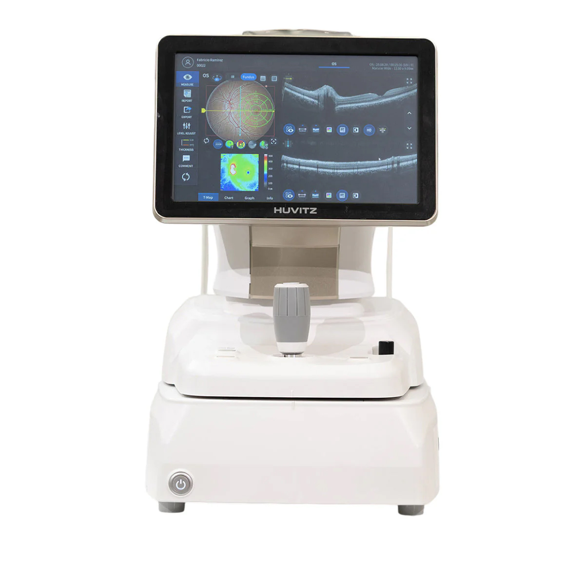 Tomógrafo de Coerência Óptica com Fundus